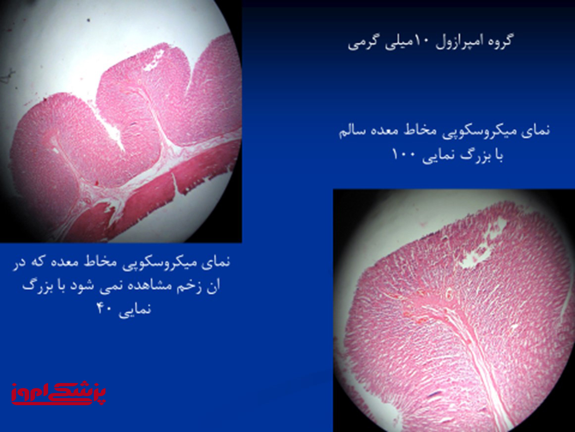 امپرازول 10 میلی گرم