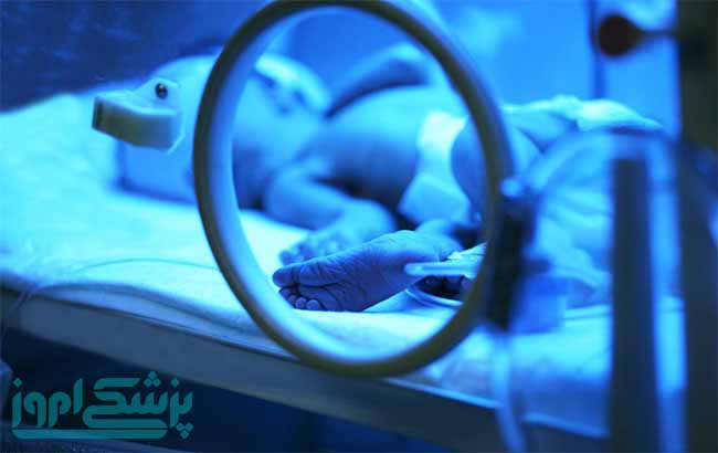 کرن ایکتروس چطور تشخیص داده می&zwnj;شود؟