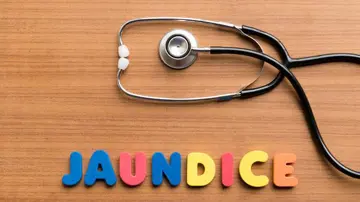 بیماری زردی